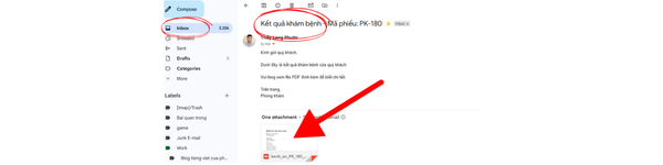 Nhận kết quả khám